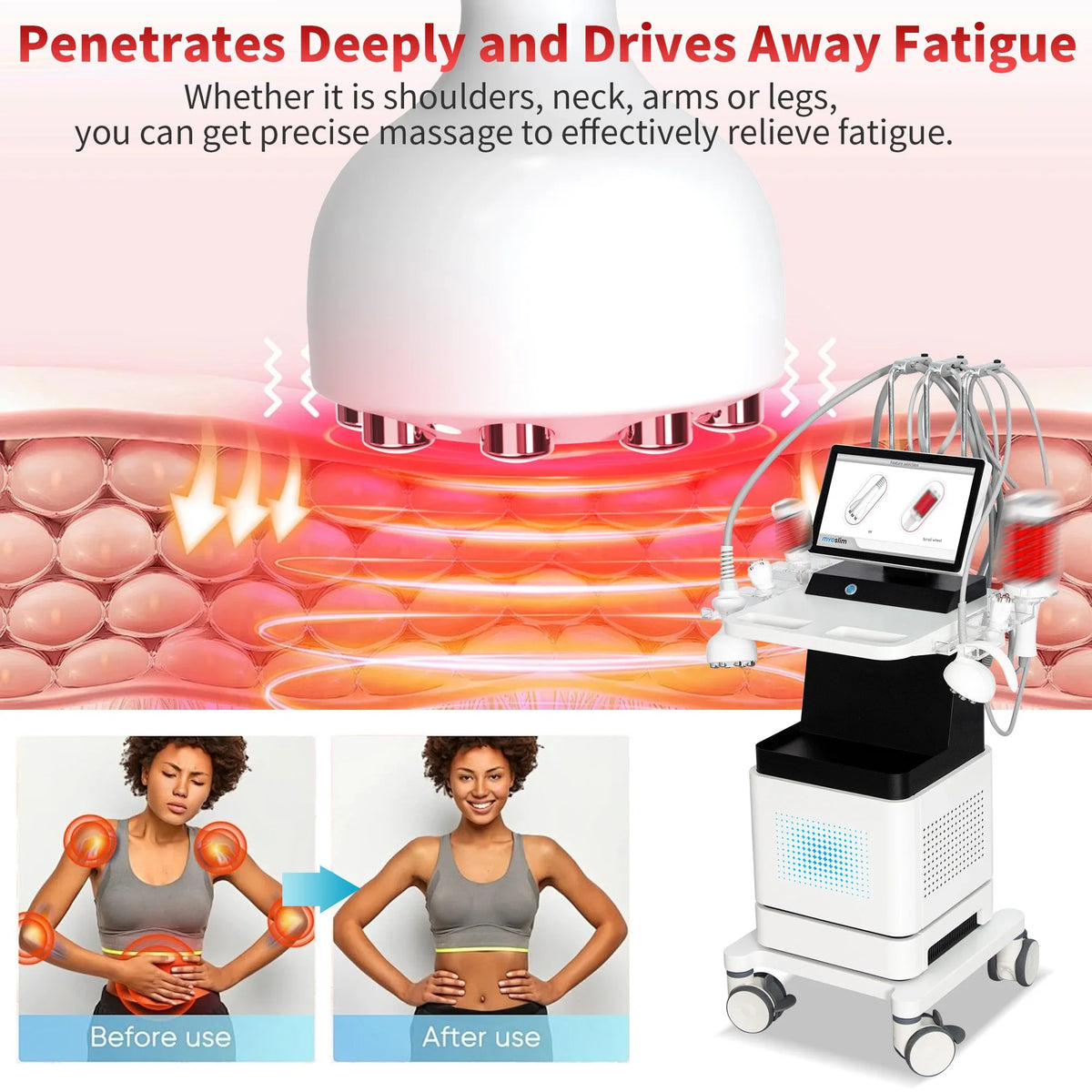 4 IN 1 RF Venus Legacy EMS Roller Slimming Cavitation Vacuum Anti Cellulite Treatment Skin Tightening Fat Burning Beauty Machine
