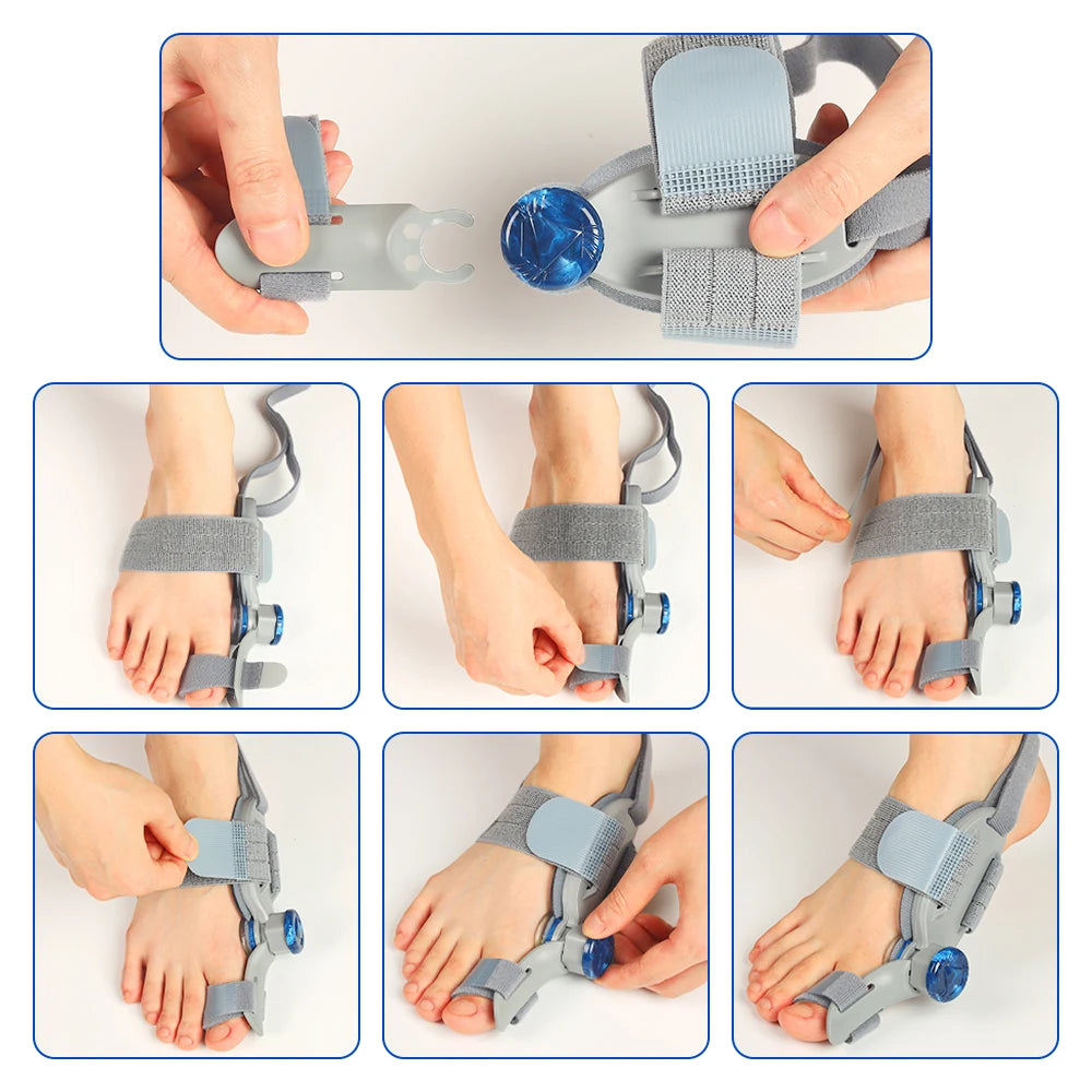 Moajaza Adjustable Bunion Aligner With Rotating Knob