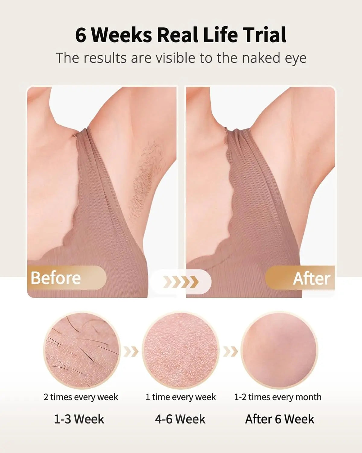 Lysmoski Painless Ice Cooling IPL Hair Remover
